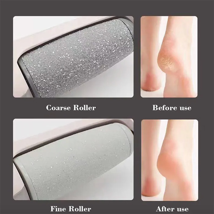 FeetBundle, rullo elettrico per rimuovere la pelle dura + calzini per piedi secchi e screpolati GRATIS - Image 7