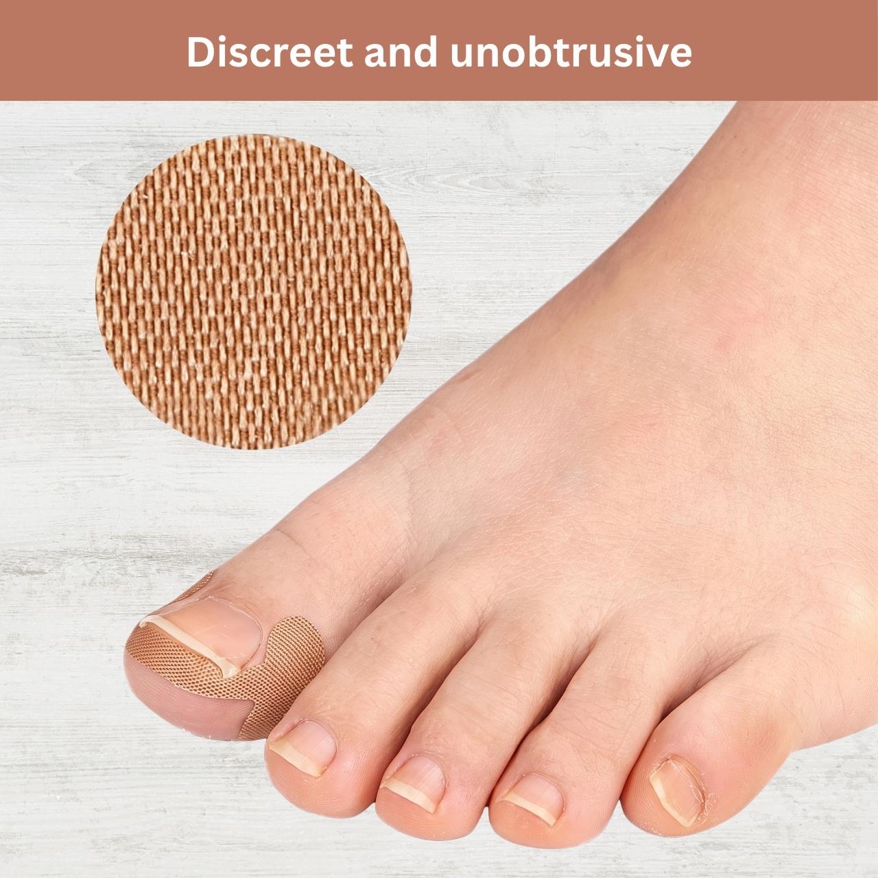 Cerotti correttivi per unghie incarnite, ProPatches - Image 10