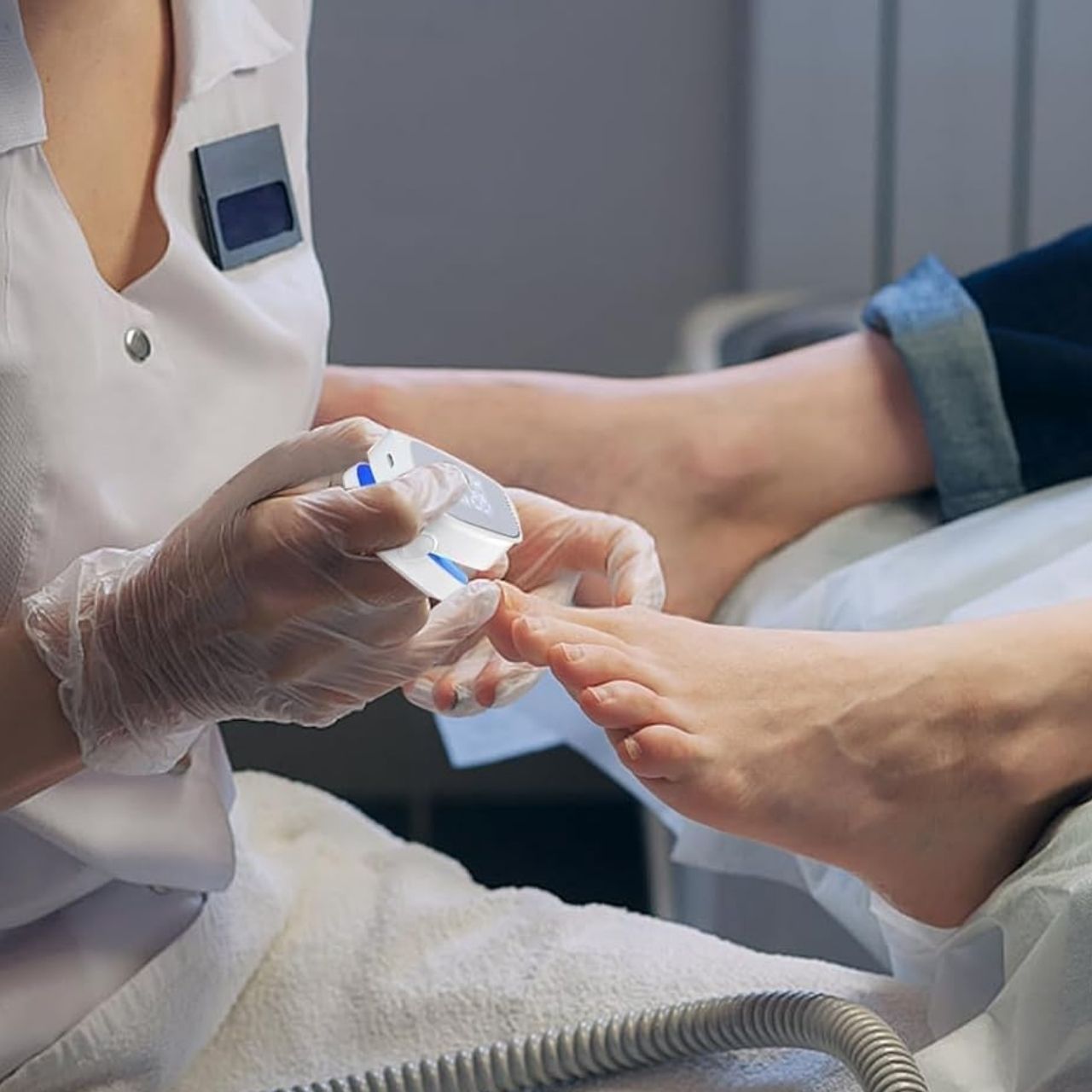 RepairNail, un dispositivo per la cura delle unghie con laser - Image 1