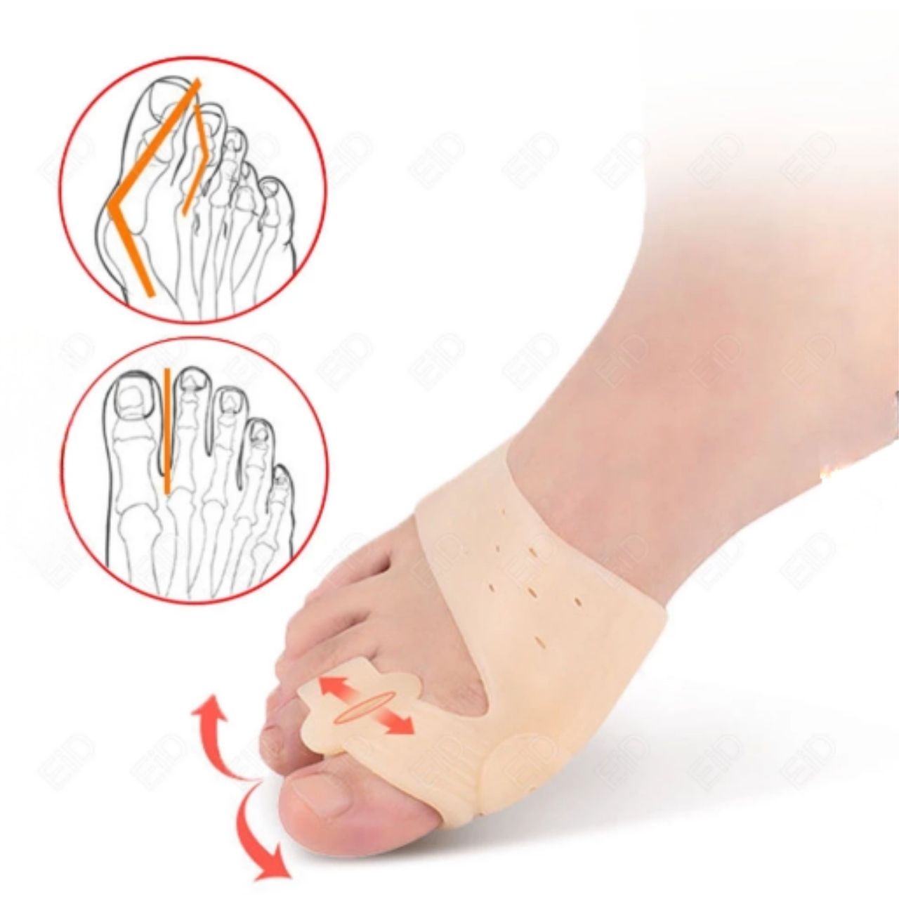ToeCorrect, un tutore per la correzione delle dita dei piedi - Image 13